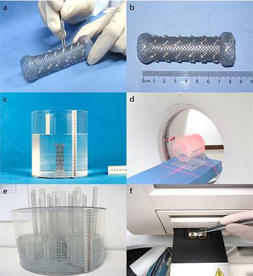 Dosimetric Evaluation and Clinical Application of Radioactive Iodine-125 Brachytherapy Stent in the Treatment of Malignant Esophageal Obstruction